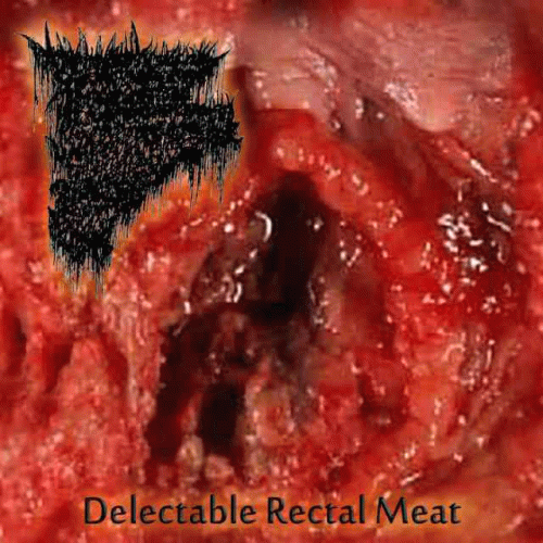 Insidious Squelching Penetration : Delectable Rectal Meat